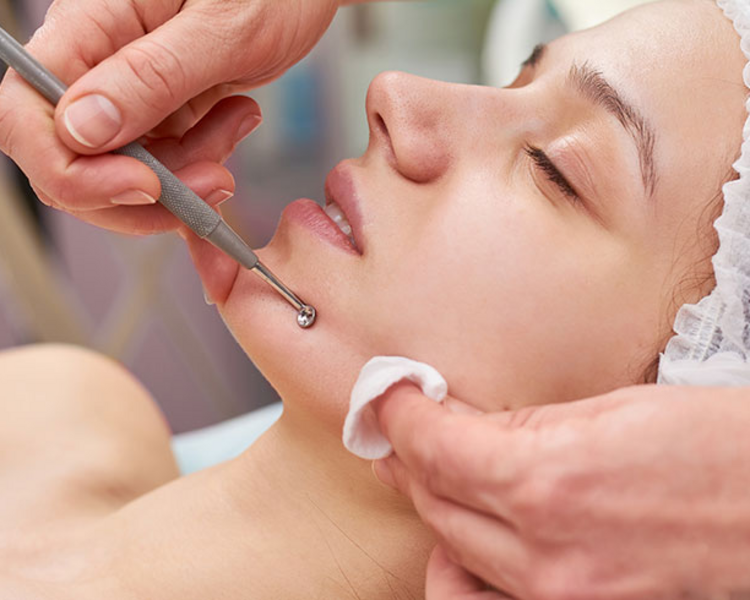 Limpieza facial profunda