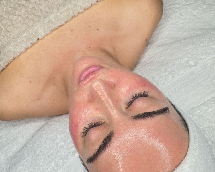 Peeling Enzimático 