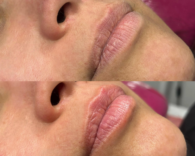 HidraLips Gloss