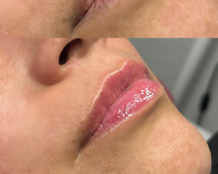 HidraLips Gloss
