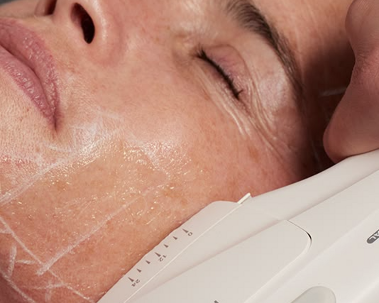 Tratamiento Anti-Age – 6 Sesiones