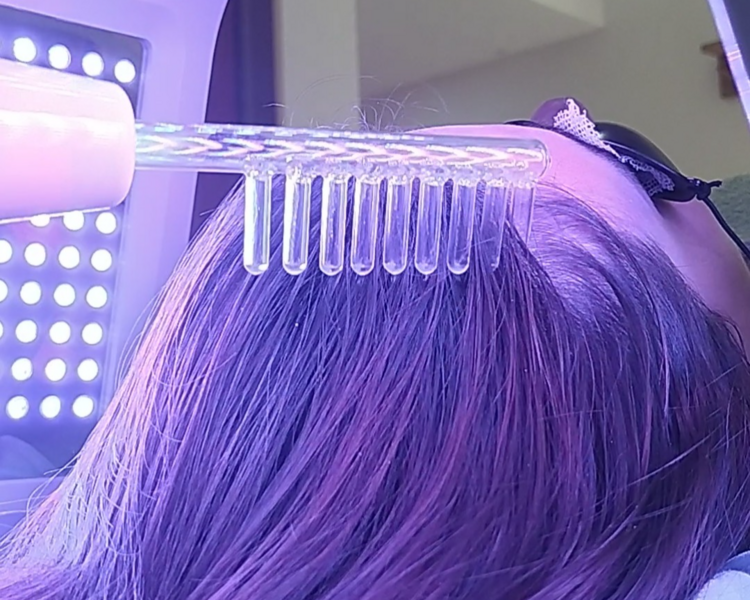 Alta frecuencia capilar 