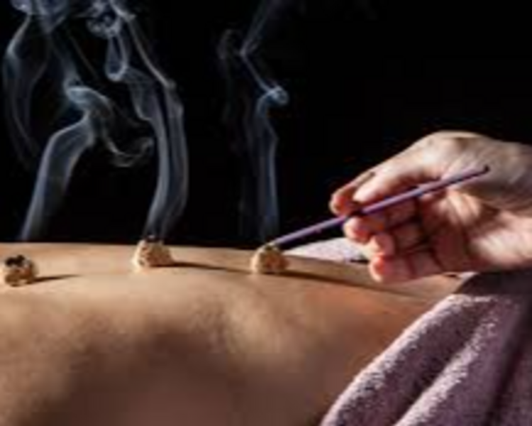 Acupuntura 4 Sesiones - Online