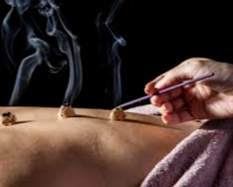 Acupuntura 4 Sesiones - Online