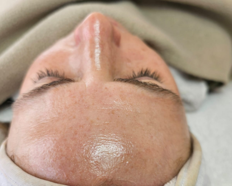 Peeling - Renová tu piel!