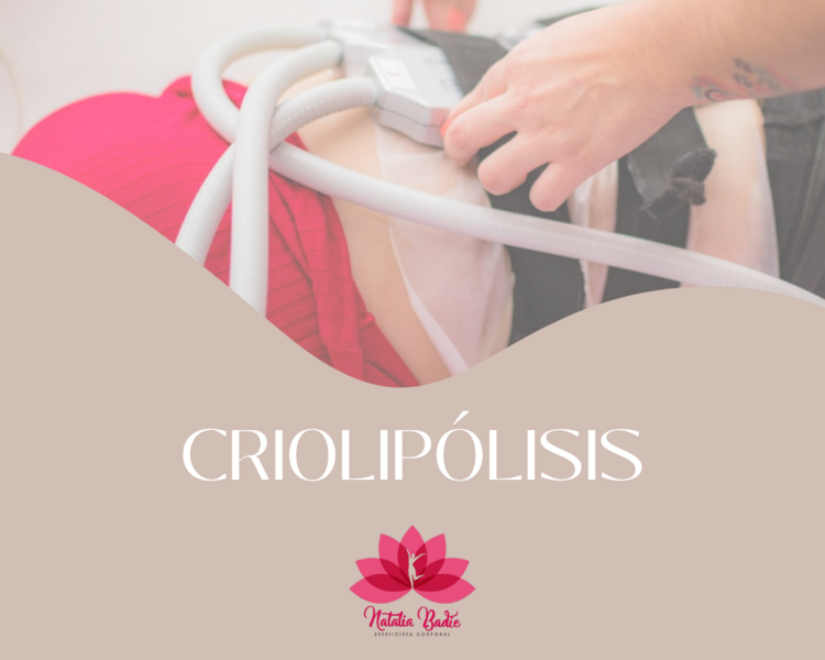 Criolipolisis por zona