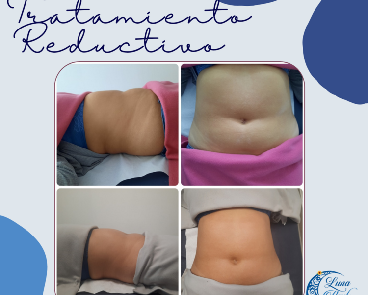 Pack tratamiento reductivo modelador (12)