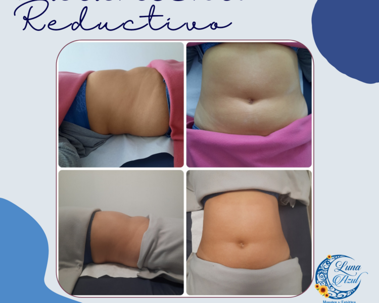 Pack tratamiento reductivo modelador (8)