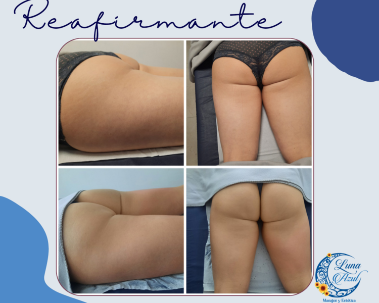 Pack tratamiento anticelulítico reafirmante (8)