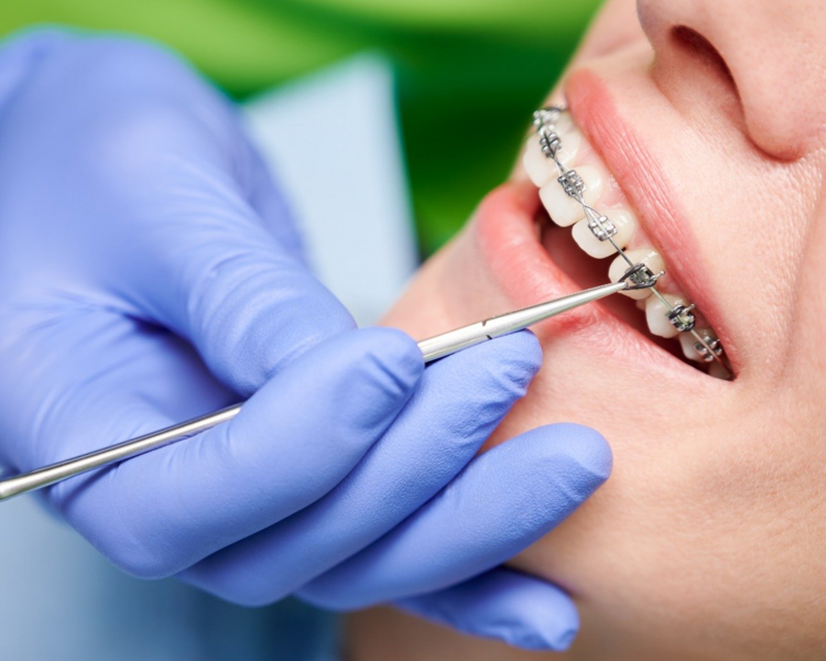 Tratamiento de Ortodoncia 