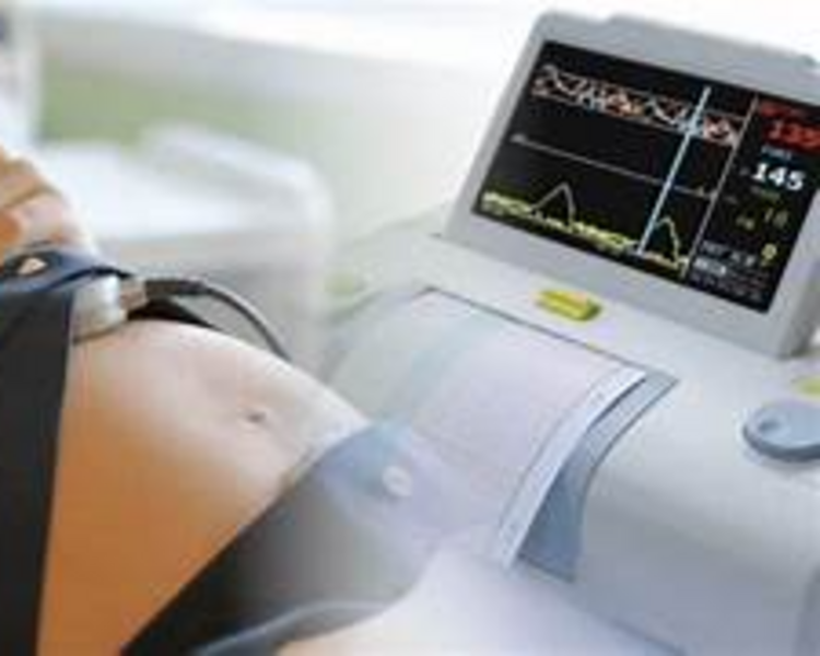 MONITOREO FETAL ELECTRONICO (RBNS)COD.2603001 M