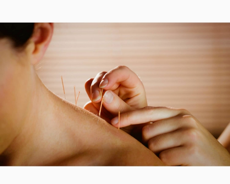 ACUPUNTURA + MASAJES DESCONTRACTURANTES