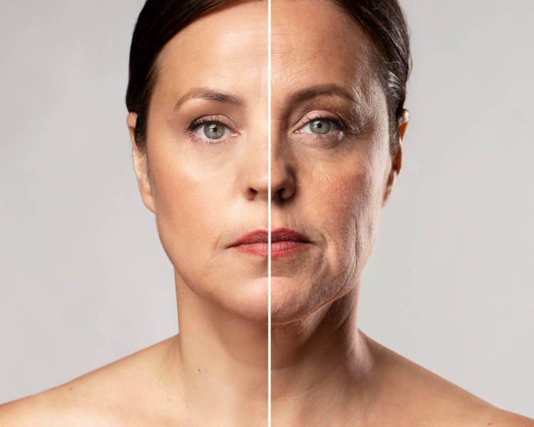 Lifting Facial con HIFU 7D