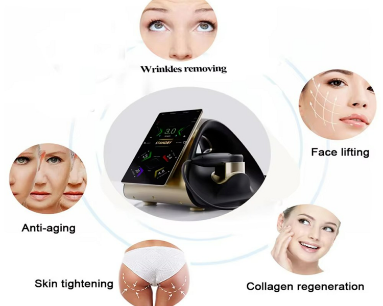Hifu Rostro, papada  y cuello