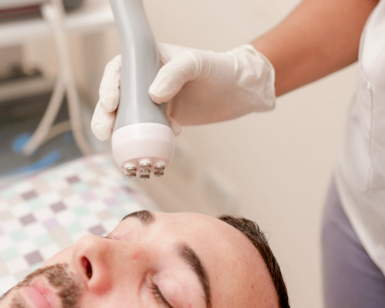 RADIOFRECUENCIA BIPOLAR FACIAL