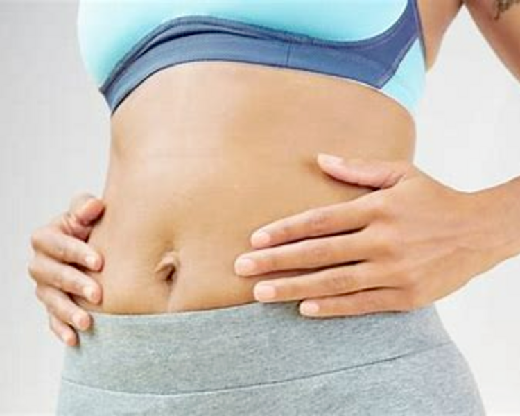 HIFU 22D MAX  CORPORAL  2 ZONAS CHICAS