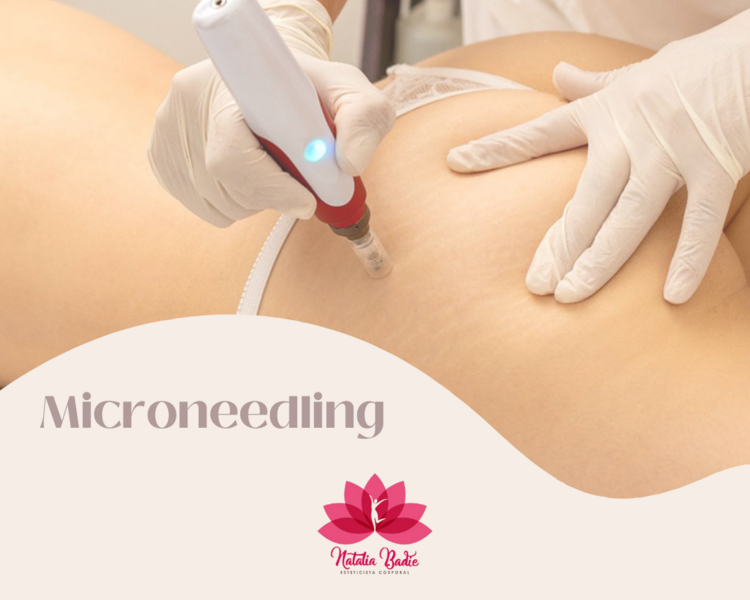 Microneedling Corporal