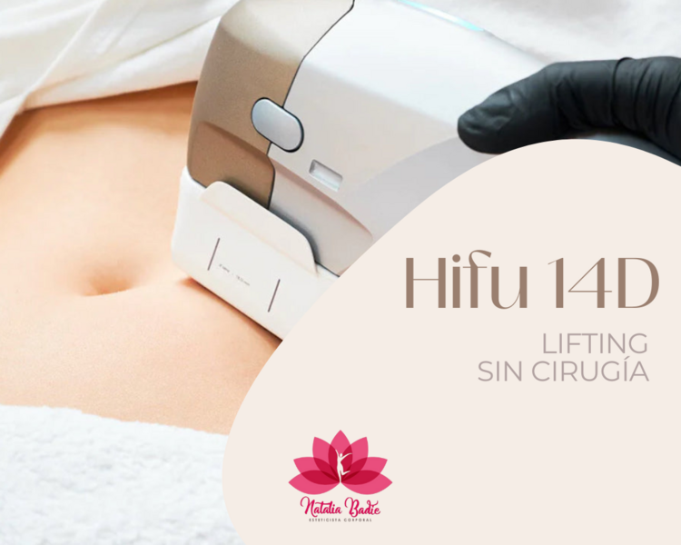 Promo Hifu 14D Abdomen, flancos y contorno de corpiño