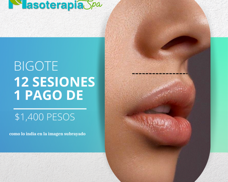 Bigote (12 Sesiones)