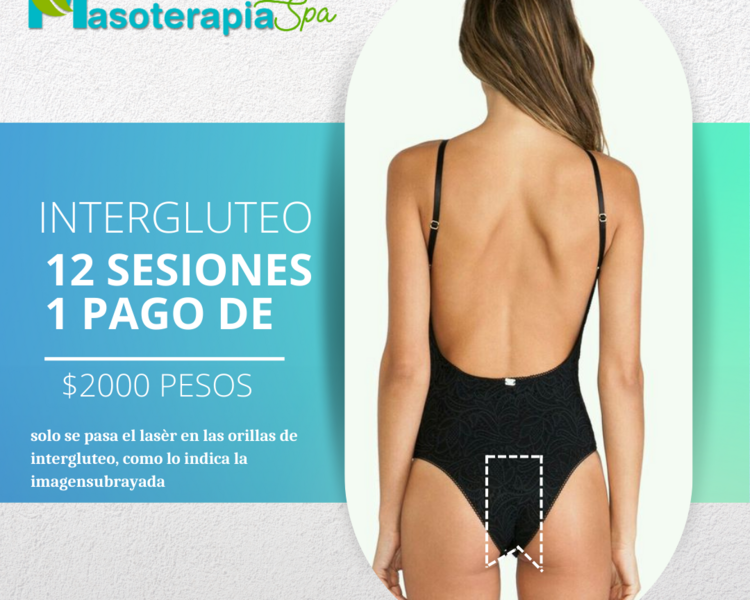 Intergluteo (12 Sesiones)