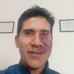 Dr. Ángel Chacón photo