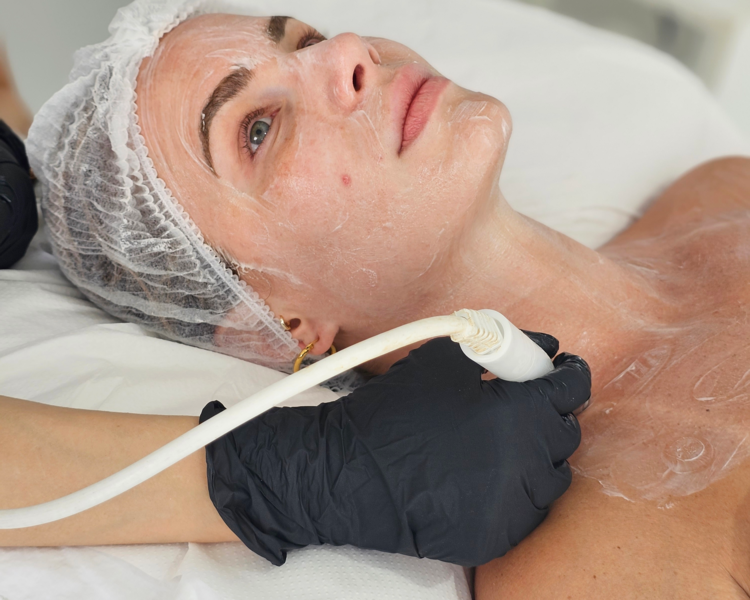 LIMPIEZA+BABY FACE (RADIOFRECUENCIA EN ROSTRO+PAPADA+CUELLO+ESCOTE)