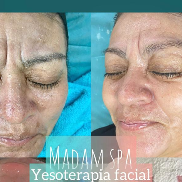 FACIAL LIMPIEZA PROFUNDA YESO