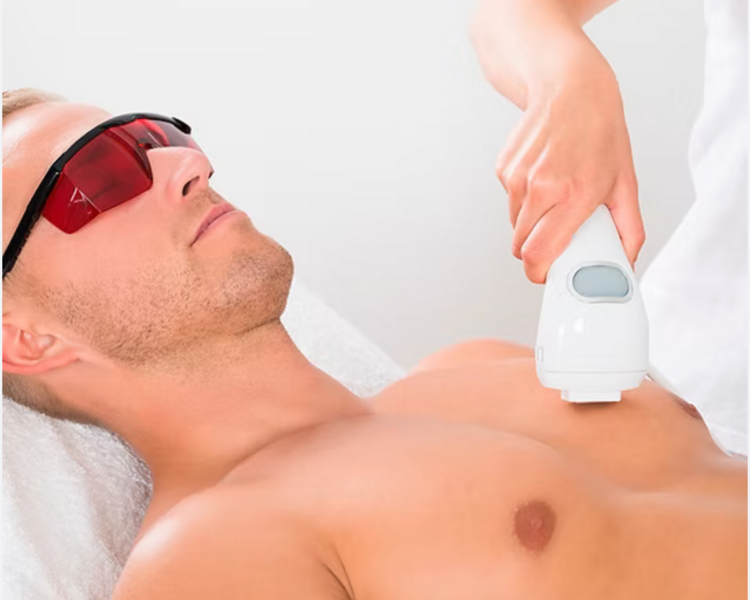 Depilación Láser Zona L (hombres)