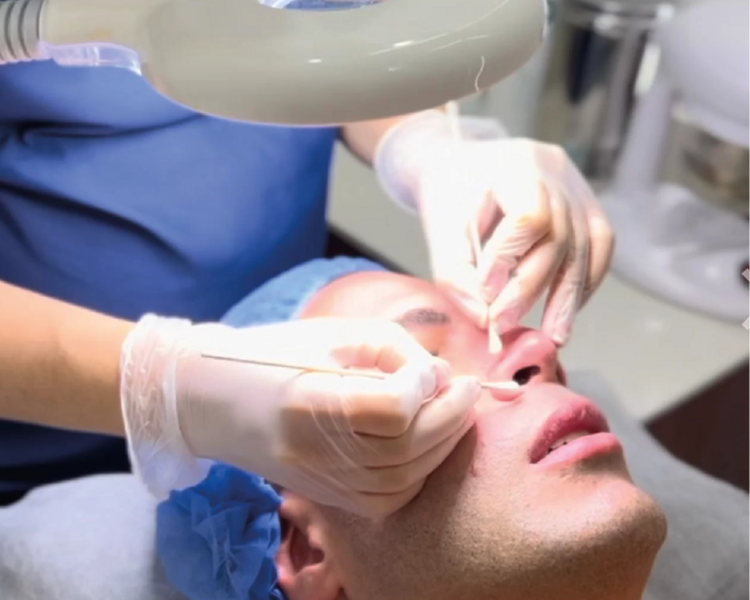 Limpieza Facial basica