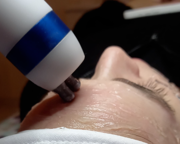 CRIORADIOFRECUENCIA FACIAL, CUELLO Y ESCOTE CON MESOTERAPIA