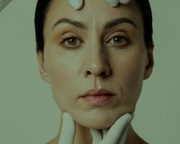 Bioestimuladores ácido polilactico