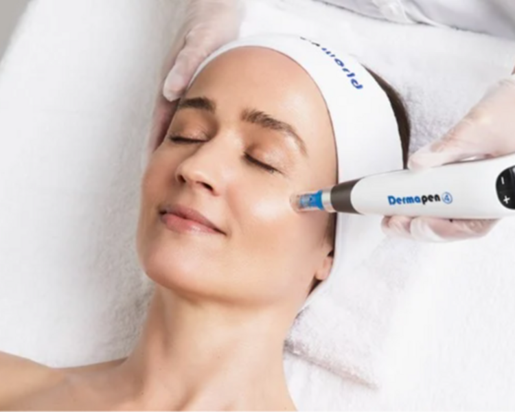 DERMAPEN O MICRONEEDLING