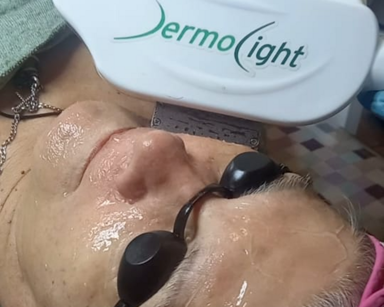 LUZ PULSADA INTENSA FACIAL 
