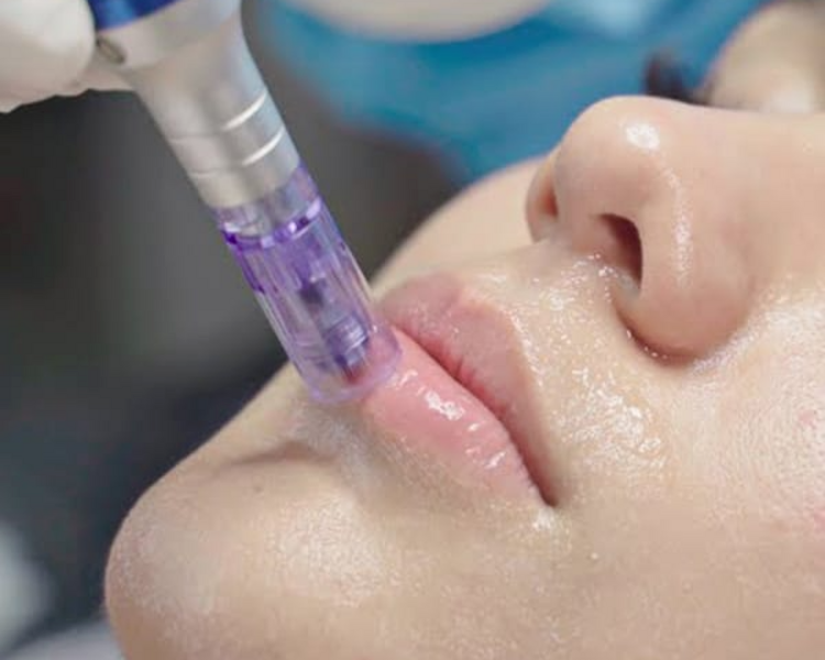 HIDRATACIÓN DE LABIOS CON ÁCIDO HIALURONICO