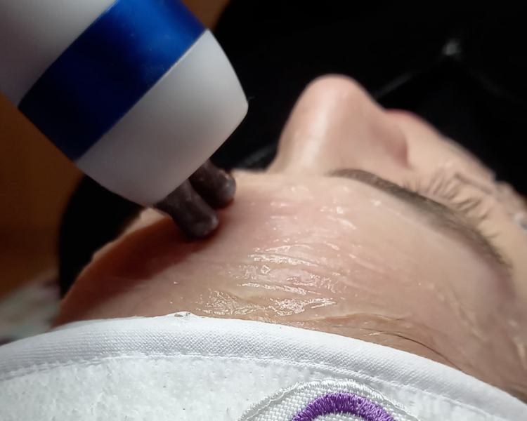 CRIORADIOFRECUENCIA FACIAL CON MESOTERAPIA