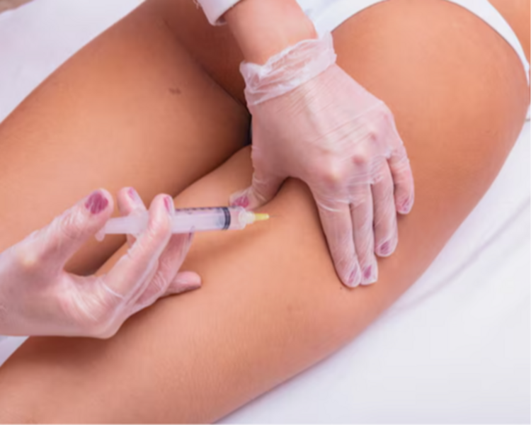 ENZIMAS PIERNA (POR ZONA)