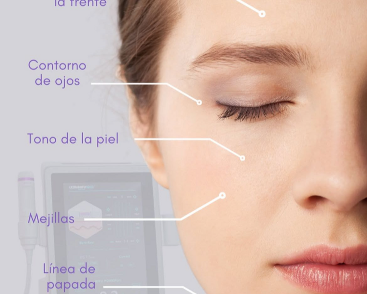 HIFU ROSTRO COMPLETO