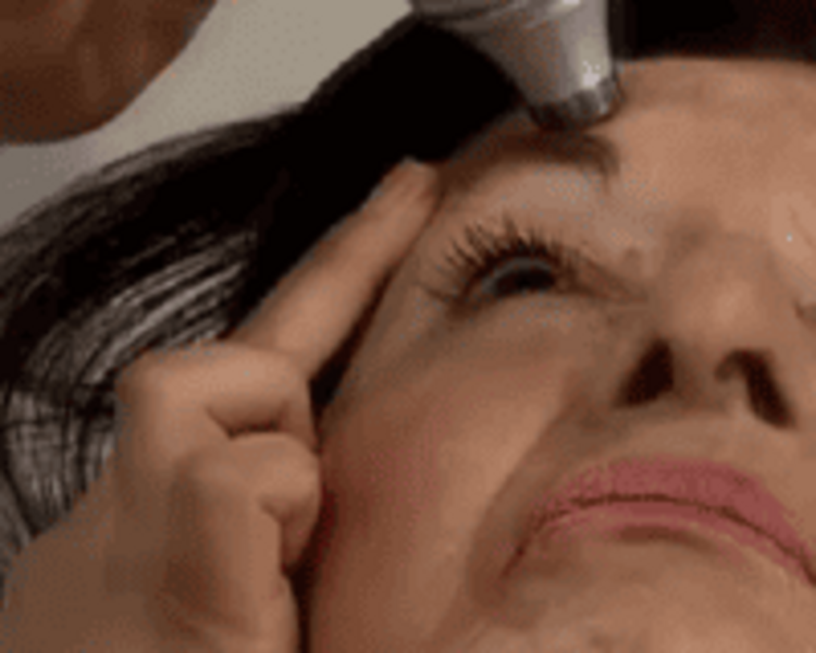 Parálisis Facial