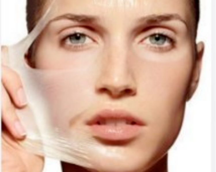 Peeling Químico
