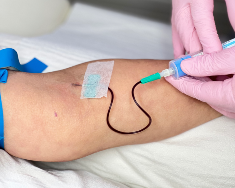 Plasma rico en plaquetas (PRP) NEW!