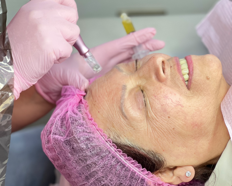 Plasma rico en plaquetas (PRP) NEW!
