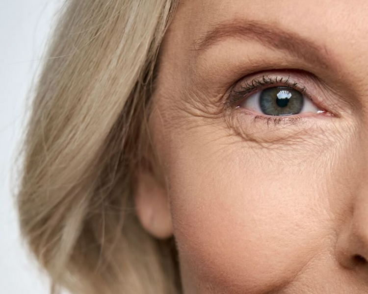 Antiage con Crioradiofrecuencia + 45 años