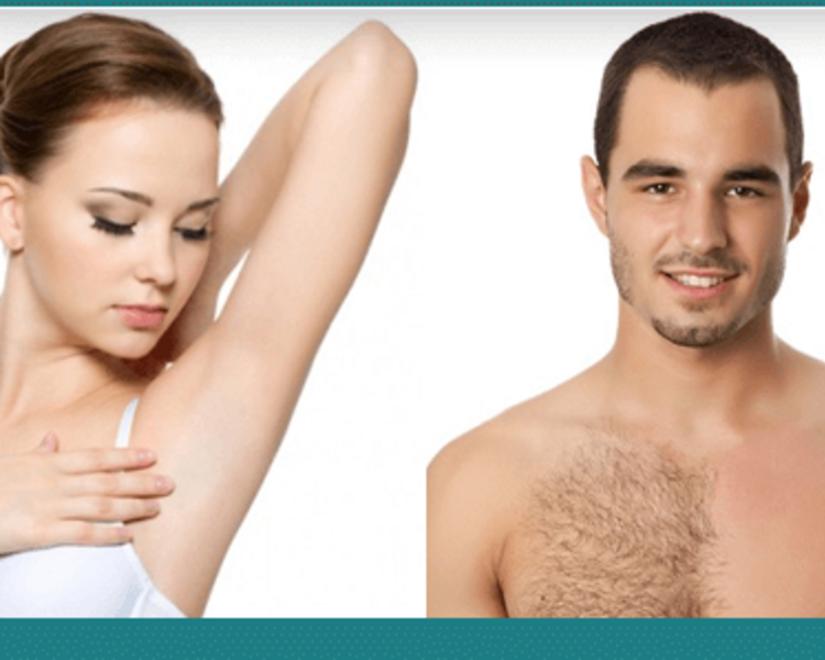 Depilación Definitiva 