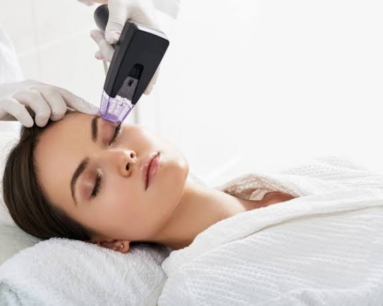 Radiofrecuencia Fraccionada