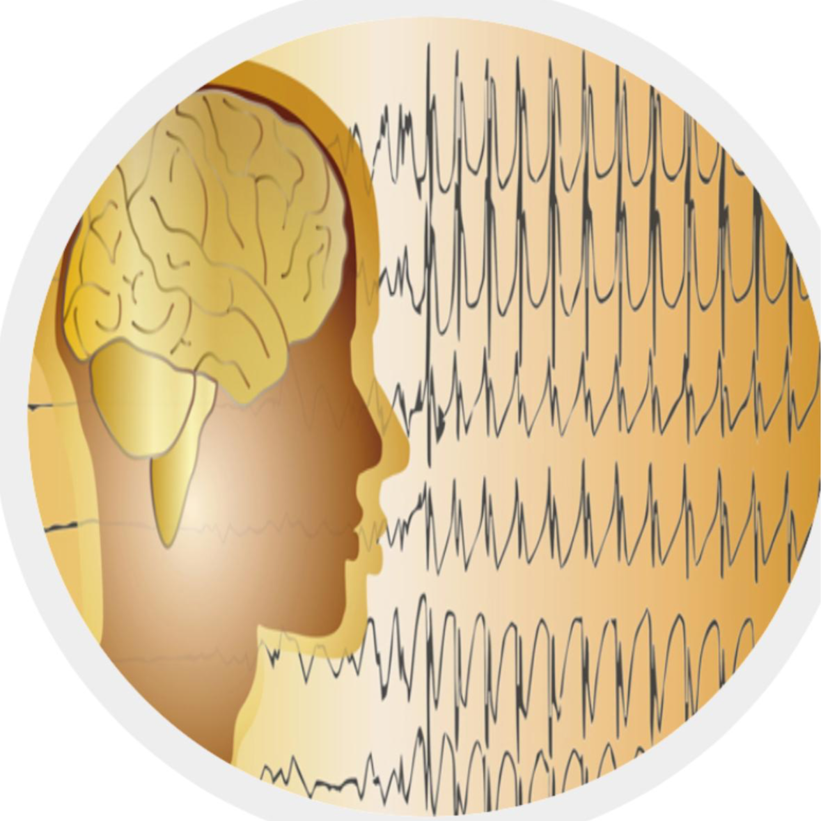 ELECTROENCEFALOGRAMA 