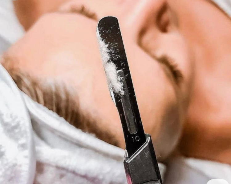 Tratamiento con dermaplaning