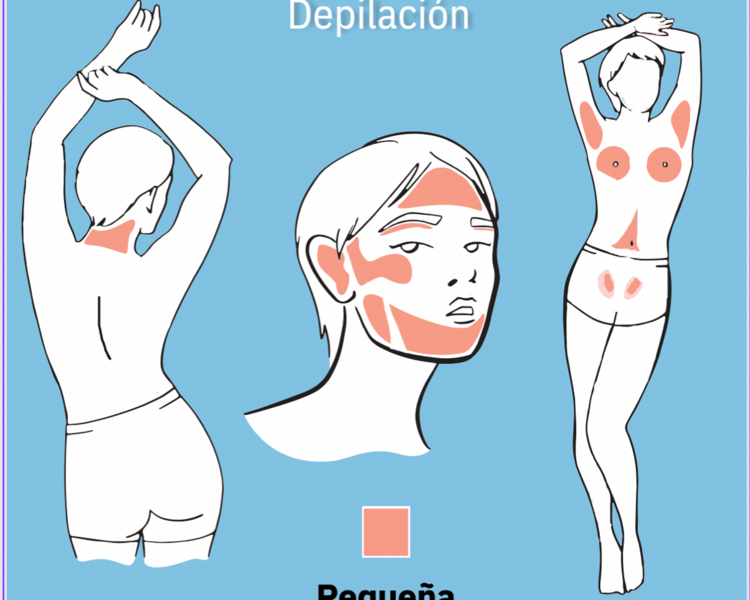 Depilación Láser Zona B (Axilas, Bikini, Busto, Coxis, Entrepierna, Mejillas, nuca, Patillas, Linea Abdomen)