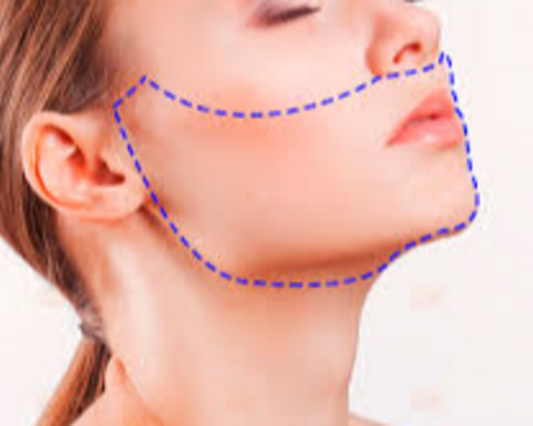 Depilación Láser Zona C (Brasileño, 1/2 Cara)