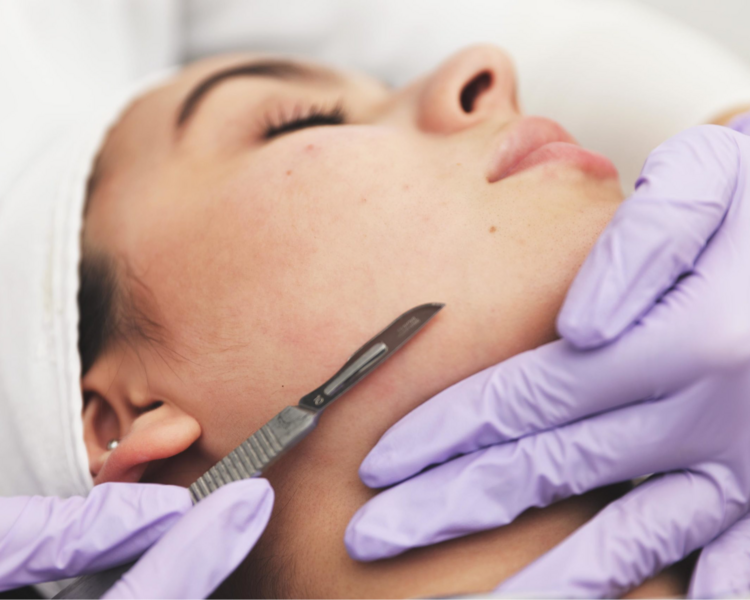 Dermaplaning