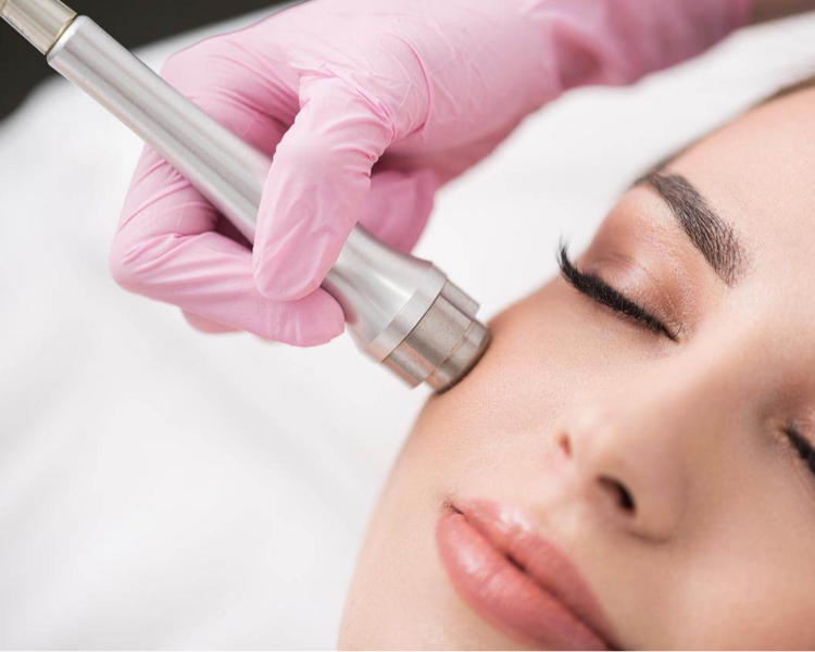 Microdermoabrasión 2.0